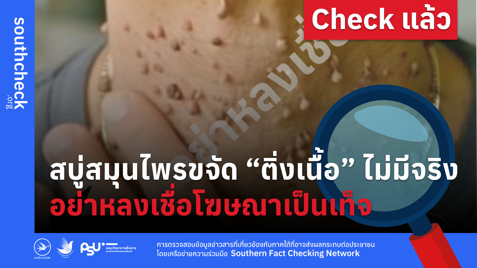สบู่สมุนไพรขจัด “ติ่งเนื้อ” ไม่มีจริง อย่าหลงเชื่อโฆษณาเป็นเท็จ